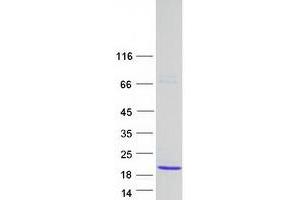 Mitotic Spindle Organizing Protein 2A (MZT2A) protein (Myc-DYKDDDDK Tag)