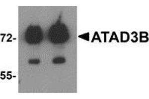 Western blot analysis of ATAD3B in human kidney tissue lysate with ATAD3B antibody at (left) 1 and (right) 2 μg/ml (ATAD3B Antikörper  (C-Term))