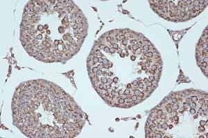 Immunohistochemistry of paraffin-embedded rat testis using Smac/Diablo Rabbit mAb (ABIN7270177) at dilution of 1:100 (40x lens). (DIABLO Antikörper)