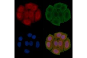 ABIN6266359 and ABIN6276704 staining Hela cells(30 min of UV treatment) by IF/ICC. (PRMT5 Antikörper  (Internal Region))