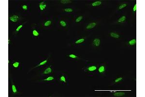 Immunofluorescence of purified MaxPab antibody to ESRRA on HeLa cell. (ESRRA Antikörper  (AA 1-423))
