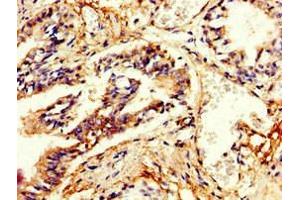 Immunohistochemistry of paraffin-embedded human lung tissue using ABIN7146632 at dilution of 1:100