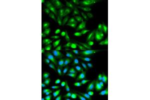 Immunofluorescence analysis of HeLa cell using RHOC antibody. (RHOC Antikörper)