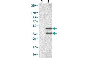 Western blot analysis of Lane 1: Negative control (vector only transfected HEK293T lysate). (UFD1L Antikörper)