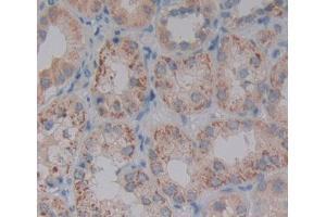 Used in DAB staining on fromalin fixed paraffin- embedded kidney tissue (PDP2 Antikörper  (AA 1-186))
