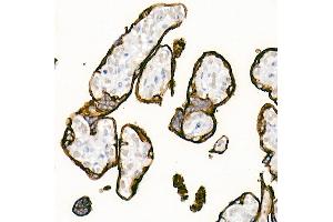 Immunohistochemistry of paraffin-embedded Human placenta using Placental alkaline phosphatase (PLAP) antibody (ABIN1682693, ABIN7101664, ABIN7101665 and ABIN7101666) at dilution of 1:1000 (40x lens). (PLAP Antikörper)