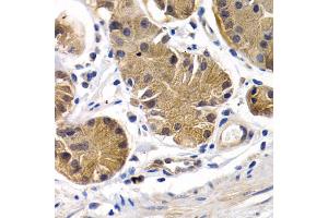 Immunohistochemistry of paraffin-embedded human stomach using PTGIR antibody. (Prostacyclin Receptor Antikörper)