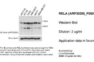 Western Blotting (WB) image for anti-Nuclear Factor-kB p65 (NFkBP65) (Middle Region) antibody (ABIN2779316) (NF-kB p65 Antikörper  (Middle Region))