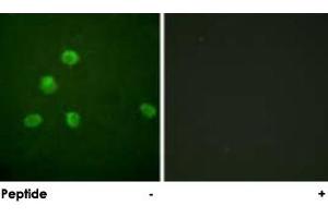 Immunofluorescence analysis of HepG2 cells, using FOSB polyclonal antibody . (FOSB Antikörper)
