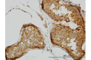 Immunoperoxidase of monoclonal antibody to CSDC2 on formalin-fixed paraffin-embedded human testis. (CSDC2 Antikörper  (AA 1-153))