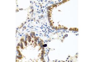 Immunohistochemistry of paraffin-embedded rat lung using C8orf4 antibody (ABIN5975014) at dilution of 1/100 (40x lens). (C8orf4 Antikörper)