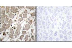 Immunohistochemistry (IHC) image for anti-Collagen, Type V, alpha 1 (COL5A1) (AA 301-350) antibody (ABIN2889916) (COL5A1 Antikörper  (AA 301-350))