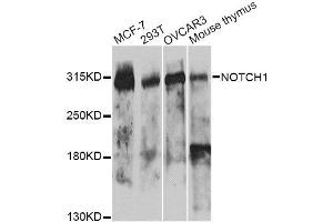 Western blot analysis of extracts of various cell lines, using NOTCH1 antibody. (Notch1 Antikörper)