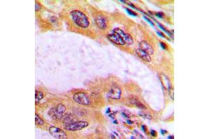 Immunohistochemistry (IHC) image for anti-UDP-Gal:betaGlcNAc beta 1,4- Galactosyltransferase, Polypeptide 3 (B4GALT3) (Center) antibody (ABIN7297432)