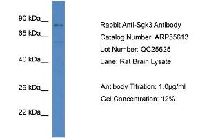 Western Blotting (WB) image for anti-serum/glucocorticoid Regulated Kinase Family, Member 3 (SGK3) (C-Term) antibody (ABIN2786286) (SGK3 Antikörper  (C-Term))