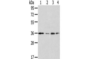 Western Blot analysis of Jurkat, A549, HepG2 and 293T cells using HOXD13 Polyclonal Antibody at dilution of 1/200 (Homeobox D13 Antikörper)