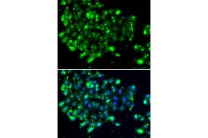 Immunofluorescence analysis of MCF7 cell using NAT9 antibody. (NAT9 Antikörper)