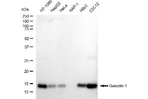 Western blotting analysis using Galectin 1 antibody (ABIN7799242).
