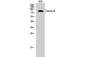 Western Blotting (WB) image for anti-Catenin, beta (CATNB) (Ser289) antibody (ABIN3183683) (beta Catenin Antikörper  (Ser289))