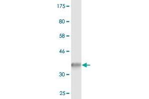 Western Blot detection against Immunogen (37. (SEC22B Antikörper  (AA 1-110))
