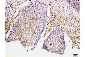 Formalin-fixed and paraffin embedded rat skin labeled with Anti-MIF Polyclonal Antibody, Unconjugated (ABIN736836) at 1:200 followed by conjugation to the secondary antibody and DAB staining. (MIF Antikörper  (AA 51-115))
