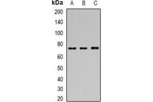 Western blot analysis of SAMHD1 expression in Hela (A), MCF7 (B), mouse spleen (C) whole cell lysates. (SAMHD1 Antikörper)
