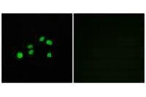Immunofluorescence analysis of HepG2 cells, using Collagen XXIII α1 antibody. (COL23A1 Antikörper)
