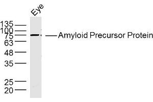 Western Blotting (WB) image for anti-Amyloid beta (A4) Precursor Protein (APP) (AA 381-480) antibody (ABIN725120)