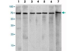 Western blot analysis using CHD3 monoclonal antibody, clone 2G4  against HeLa (1), K-562 (2), Jurkat (3), NTERA-2 (4), HEK293 (5), Raji (6) cell lysate and mouse brain (7) tissue lysate.