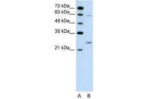 WB Suggested Anti-GAMT  Antibody Titration: 0. (GAMT Antikörper  (N-Term))