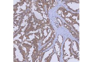 IHC analysis of WDR44 using anti-WDR44 antibody (ABIN7600394). (WDR44 Antikörper  (AA 188-913))