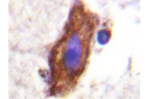 Immunohistochemistry analyzes of AP20219PU-N CSFR antibody in paraffin-embedded human brain tissue. (CSF1R Antikörper)