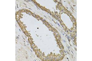 Immunohistochemistry of paraffin-embedded human prostate using PIK3CA antibody. (PIK3CA Antikörper)