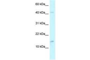 Image no. 1 for anti-Pterin-4 alpha-Carbinolamine Dehydratase/dimerization Cofactor of Hepatocyte Nuclear Factor 1 alpha (TCF1) 2 (PCBD2) (AA 71-120) antibody (ABIN6747530) (PCBD2 Antikörper  (AA 71-120))