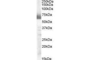 Western Blotting (WB) image for Cytochrome P450, Family 17, Subfamily A, Polypeptide 1 (CYP17A1) peptide (ABIN369408)