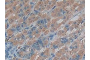Used in DAB staining on fromalin fixed paraffin- embedded stomach tissue (Cathepsin L Antikörper  (AA 114-288))