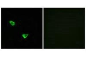 Immunofluorescence analysis of MCF-7 cells, using CHSS2 antibody. (CHPF Antikörper)
