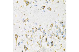 Immunohistochemistry of paraffin-embedded Mouse brain using ADIPOQ antibody (ABIN3016228, ABIN3016229, ABIN3016230 and ABIN6219638) at dilution of 1:100 (40x lens). (ADIPOQ Antikörper  (AA 19-104))
