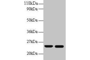 Western blot All lanes: RBP4 antibody at 2 μg/mL Lane 1: Human positive serum at 1: 10 Lane 2: Human positive serum at 1: 100 Secondary Goat polyclonal to rabbit IgG at 1/50000 dilution Predicted band size: 24 kDa Observed band size: 24 kDa (RBP4 Antikörper  (AA 19-201))