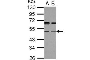 Western Blotting (WB) image for anti-TAP Binding Protein-Like (TAPBPL) (AA 140-399) antibody (ABIN1501298)