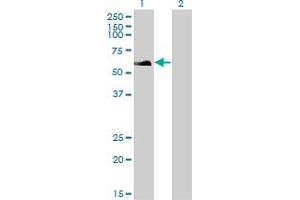 Western Blot analysis of RAD18 expression in transfected 293T cell line by RAD18 monoclonal antibody (M01), clone 3H7. (RAD18 Antikörper  (AA 332-430))