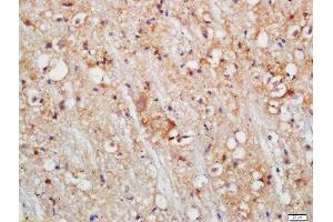 Formalin-fixed and paraffin embedded mouse brain labeled with Rabbit Anti-PLDL1 Polyclonal Antibody, Unconjugated (ABIN754588) at 1:200 followed by conjugation to the secondary antibody and DAB staining (PLCL1 Antikörper  (AA 1001-1096))