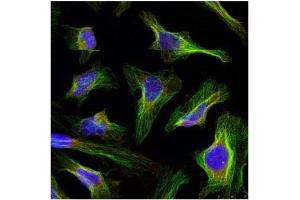 Image no. 2 for anti-B-Cell CLL/lymphoma 2 (BCL2) (AA 54-58) antibody (ABIN197202) (Bcl-2 Antikörper  (AA 54-58))