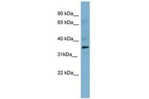 Image no. 2 for anti-Mesothelin (MSLN) (AA 395-444) antibody (ABIN6741693) (Mesothelin Antikörper  (AA 395-444))