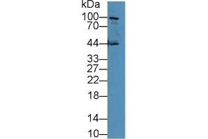 Western Blotting (WB) image for anti-Cadherin 1, Type 1, E-Cadherin (Epithelial) (CDH1) (AA 751-884) antibody (ABIN7437818)