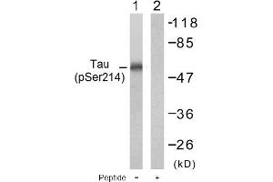 Image no. 1 for anti-Microtubule-Associated Protein tau (MAPT) (pSer214) antibody (ABIN196804) (MAPT Antikörper  (pSer214))