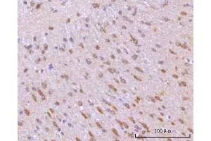 IHC analysis of RIMBP2 using anti-RIMBP2 antibody (ABIN7601441). (RIMBP2 Antikörper  (AA 351-1049))