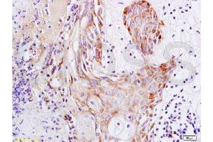 Immunohistochemistry (Paraffin-embedded Sections) (IHC (p)) image for anti-S100 Calcium Binding Protein A7A (S100A7A) (AA 41-108) antibody (ABIN718301)