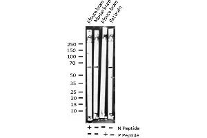 ELK1 Antikörper  (pSer383)