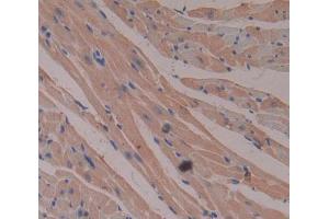 IHC-P analysis of Human Tissue, with DAB staining. (CKMT2 Antikörper  (AA 40-419))